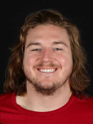 Porcelain Veneers McKade - Before