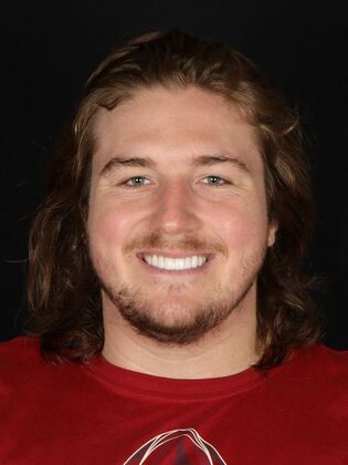 Porcelain Veneers McKade - After