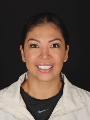 Porcelain Veneers Angela - Before