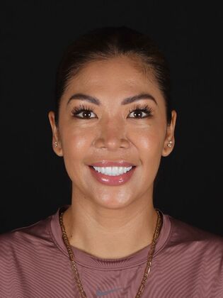 Porcelain Veneers Angela - After