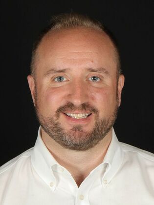 Porcelain Veneers Doug - Before