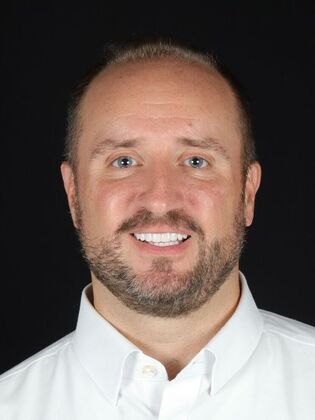 Porcelain Veneers Doug - After