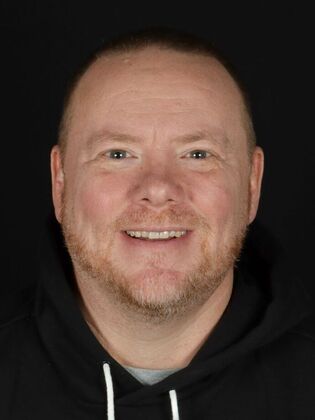 Porcelain Veneers Jeff - Before