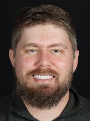 Porcelain Veneers Craig - After