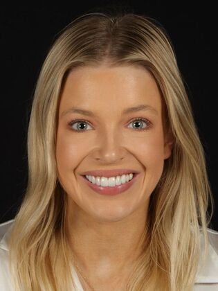 Porcelain Veneers: Casey - After