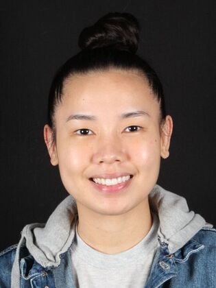 Porcelain Veneers: Cynthia - Before