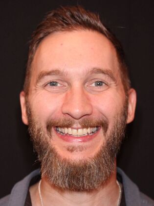 Porcelain Veneers James - Before