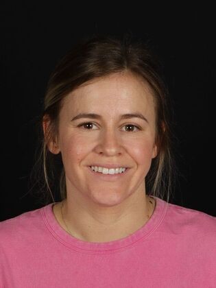 Porcelain Veneers Jaimie  - Before