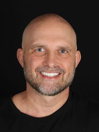 Porcelain Veneers: Paul - After