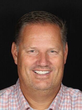 Porcelain Veneers Walt - After