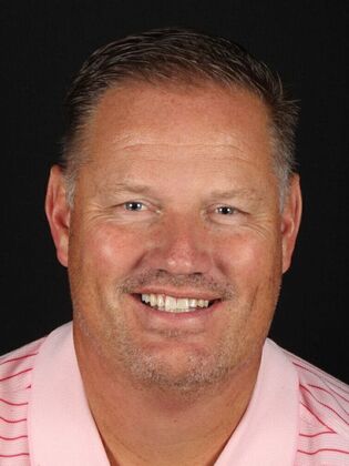 Porcelain Veneers Walt - Before