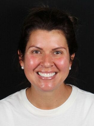 Porcelain Veneers: Kelly - Before