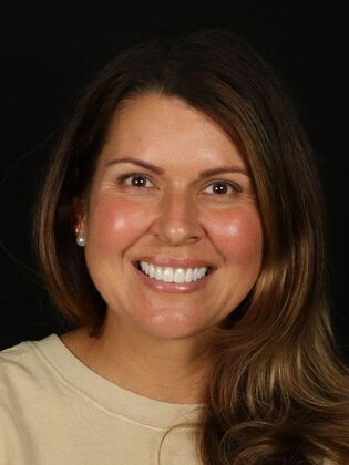 Porcelain Veneers: Kelly - After