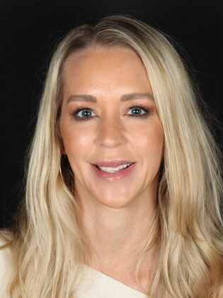 Porcelain Veneers RoseAnne - Before