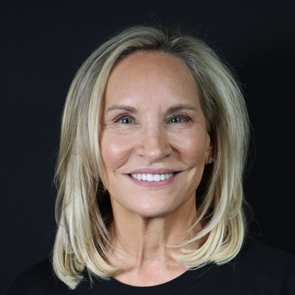 Minimal Prep Porcelain Veneers Barbara - After