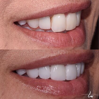 Before And After Transformations Case 2