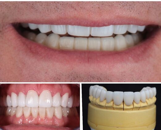 Before And After Transformations Case 5