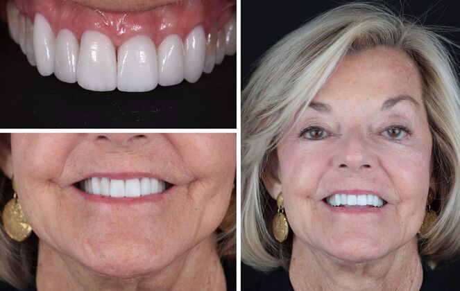 Before And After Transformations Case 6