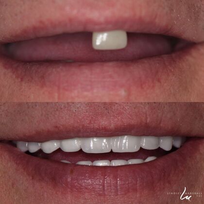 Before And After Transformations Case 8