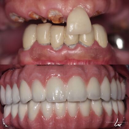 Before And After Transformations Case 9