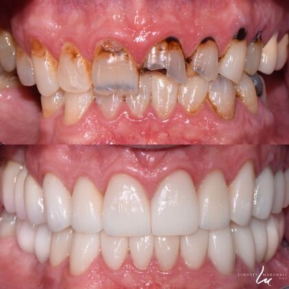Before And After Transformations Case 24