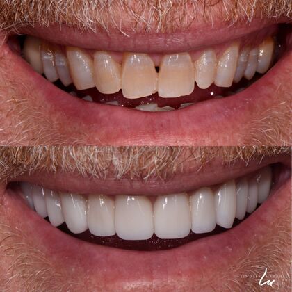 Before And After Transformations Case 36