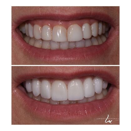 Before And After Transformations Case 40