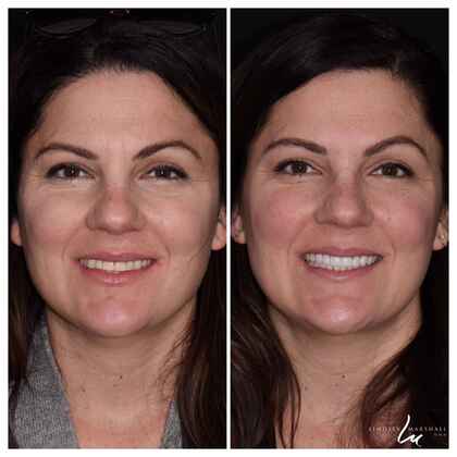 Before And After Transformations Cases