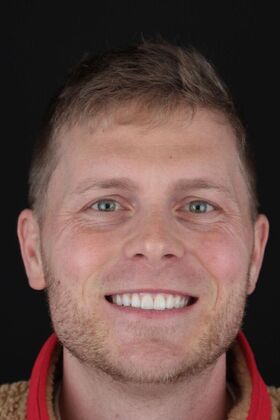 Patient Results Case 15