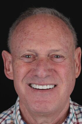 Patient Results Case 16