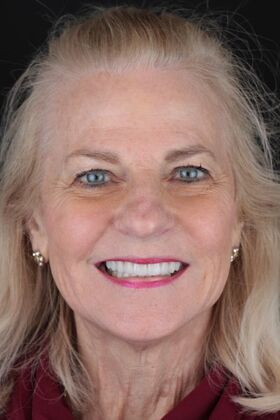 Patient Results Case 18