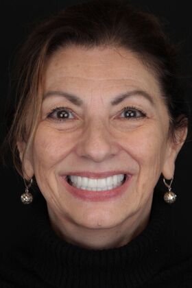 Patient Results Case 19