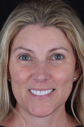 Patient Results Case 21