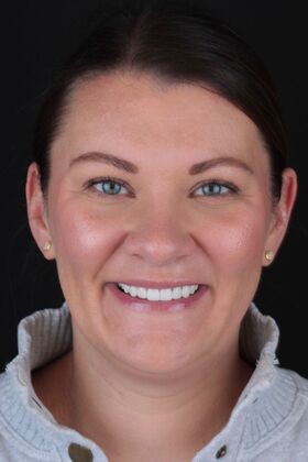 Patient Results Case 24