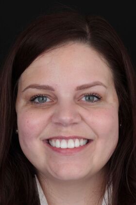 Patient Results Case 25