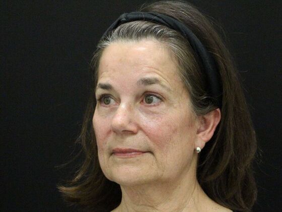 Face & Neck Lifts: Case 46 - Before