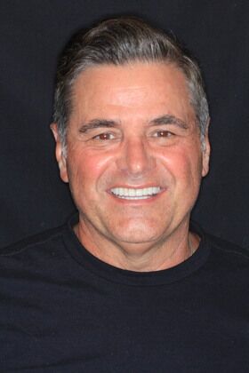 Porcelain Crowns Cases