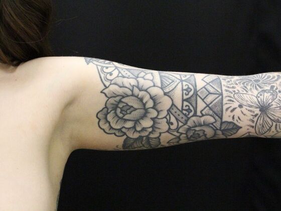 Arm Lift & Reduction: Case 9 - Before