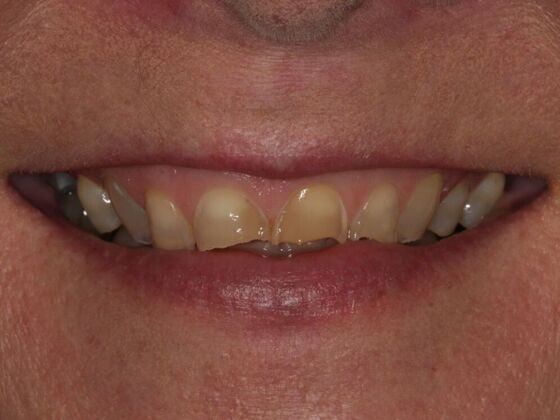 Cosmetic Case 1 - Before