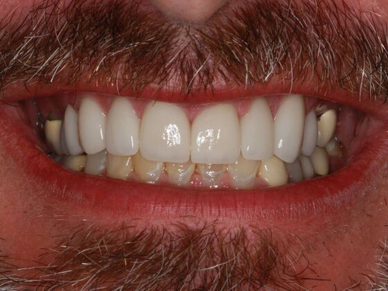 Cosmetic Case 2 - After