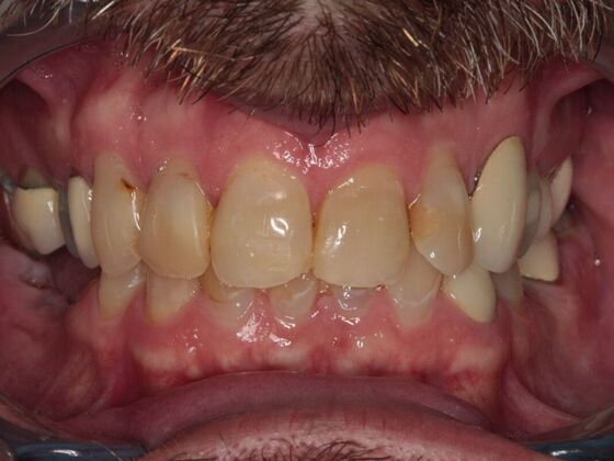 Cosmetic Case 2 - Before