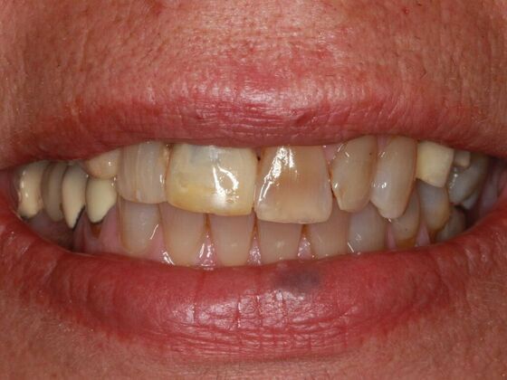 Cosmetic Case 3 - Before