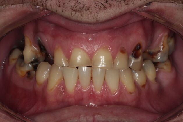 Cosmetic Case 4 - Before