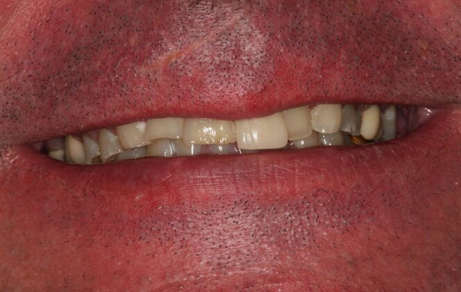 Cosmetic Case 5 - Before