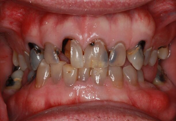 Cosmetic Case 7 - Before