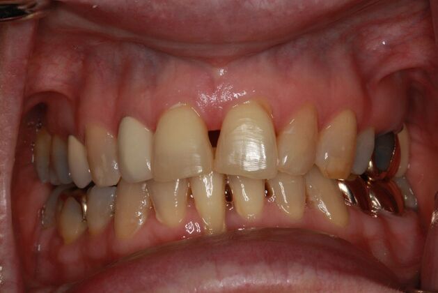 Cosmetic Case 8 - Before