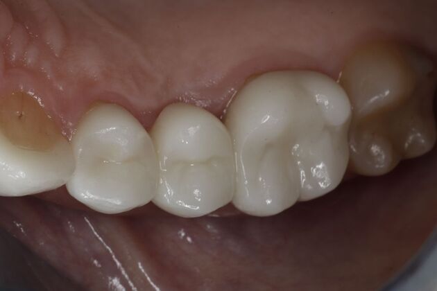 Cosmetic Dentistry: Cosmetic Dentistry Case 11 - Before