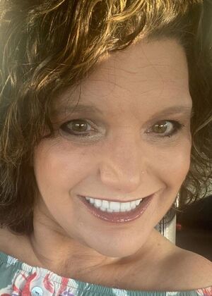 Dental Implants Case 4 - After