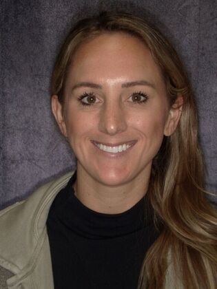 Our Smile Transformations Madison - Before