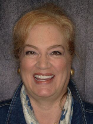 Our Smile Transformations Leslie - After